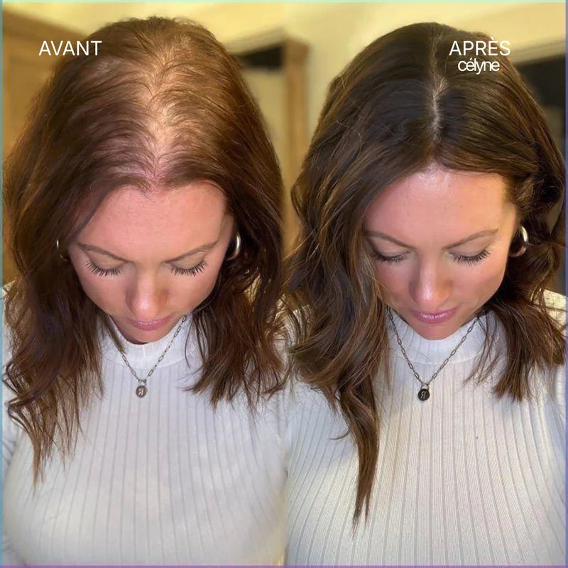 Avant / Après — Amélie, 34 ans