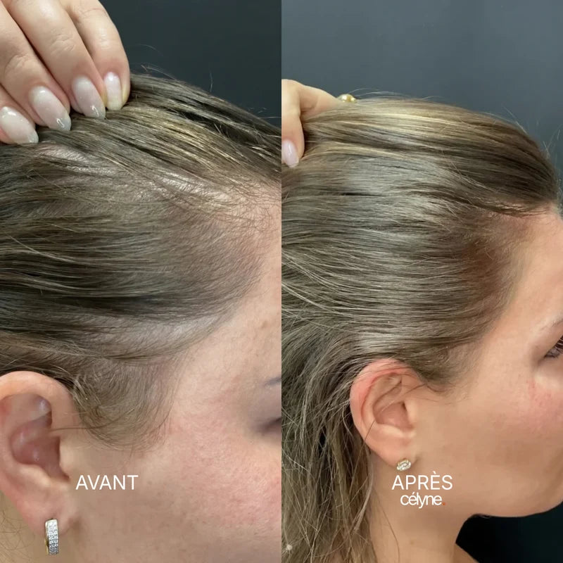 Avant / Après — Nathalie, 39 ans