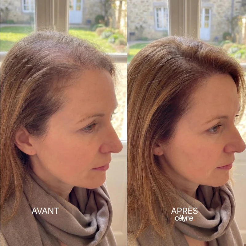 Avant / Après — Isabelle, 58 ans