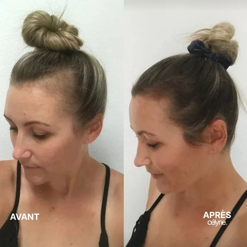 Avant / Après — Jessica, 39 ans