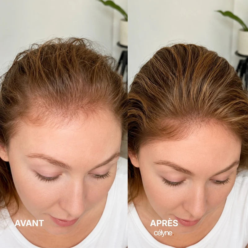 Avant / Après — Jessy, 35 ans